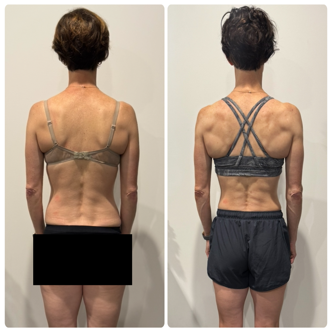 Annie before and after transformation