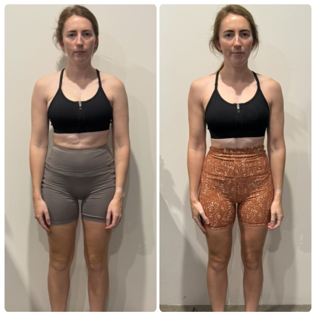 Carley before and after transformation