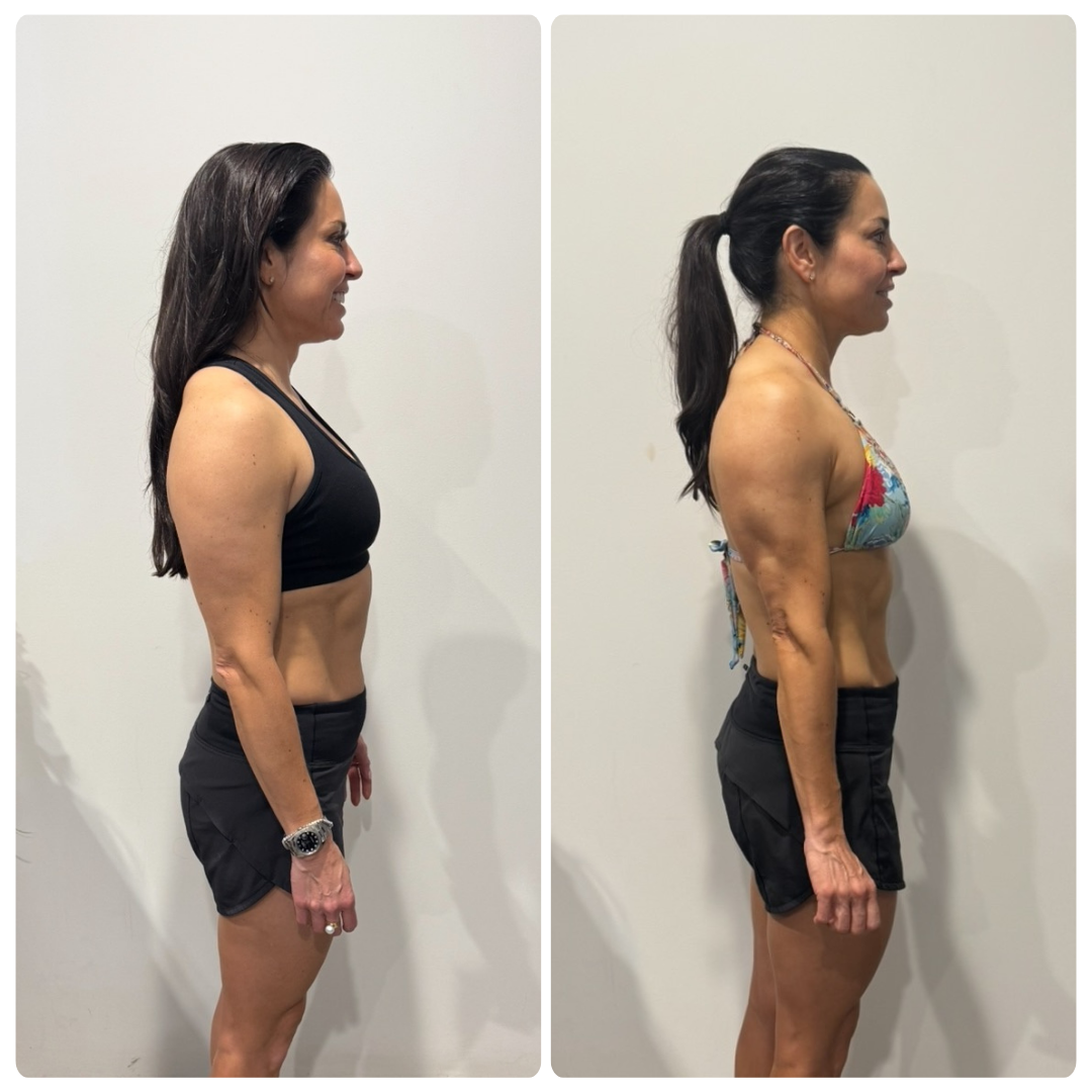 Yvonne before and after transformation, side view